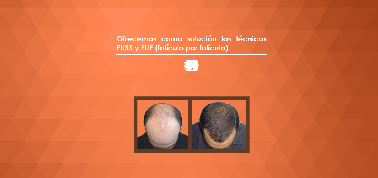 tecnicasfussfue
